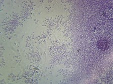 Proteus Vulgaris; Smear; Gram-Negative