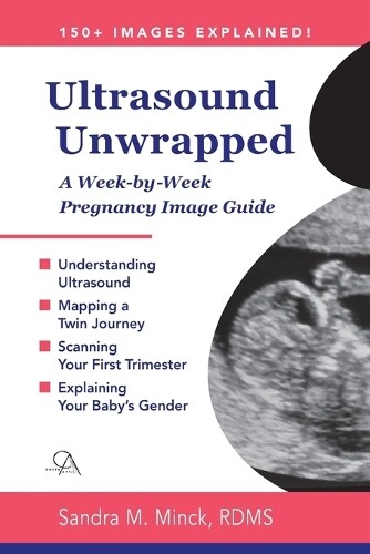 Thumbnail - Sandra M Minck Rdms Ultrasound Unwrapped (taschenbuch) (us Import)