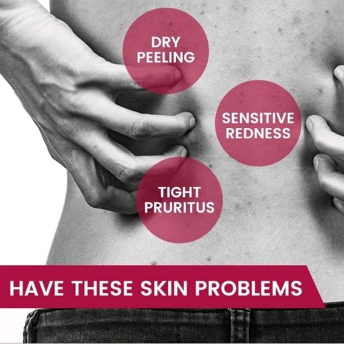 CeraVe ITCH RELIEF MOISTURISING CREAM - Relieves Itching & Skin Irritations 340g - Picture 4 of 6