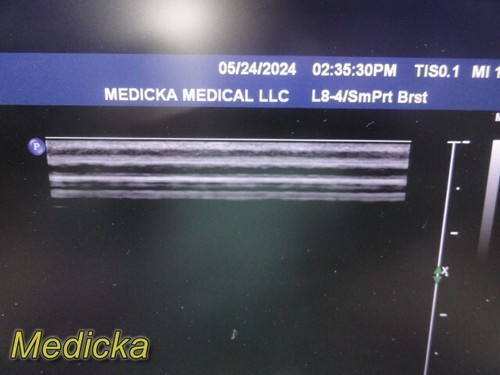 Philips L8-4 Linear Array Ultrasound Transducer Probe; Ref 453561167101 ~ 34616 - Picture 3 of 21