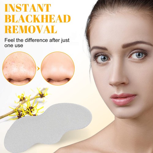White Nose Pore Blackhead Removal Strips Deep Pores Cleansing Strips 1 To 100 - Picture 2 of 14