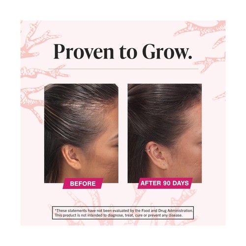 Viviscal Women's Hair Growth Supplement – Nourish Thinning Hair and Increa - Picture 7 of 12