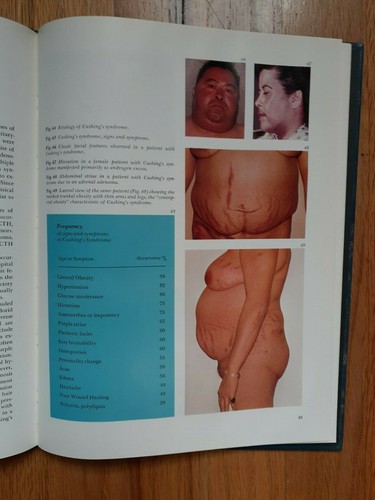 The Adrenal Cortex by John Bethune, MD, 1975, Upjohn Scope Monograph, 68 pages - Picture 6 of 8