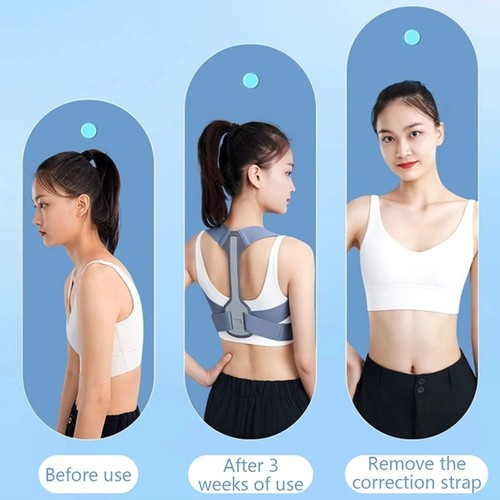 Adjustable Back Posture Corrector Scoliosis Back Brace Daily Wear - Picture 11 of 21