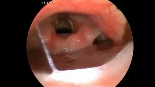 Endoscopy Camera Manufacturer with free shipping Manufacturer with free shipping - Picture 11 of 14
