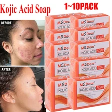 1~10x Kojic Acid Soap Acne Dark Spot Remover Skin Lightening Whitening Face Body