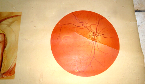 ALCON PHARMACEUTICAL EYE CLINIC OPHTHALMOLOGIST MAP POSTER 24x47" GERMANY 1950s - Picture 9 of 14