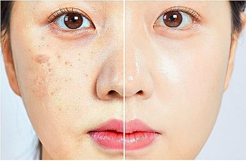 Ultimate Rejuvenation ─PDRN(20%) + Copper Peptide(8%) Glutathione Ampoule (5ml) - Picture 7 of 10