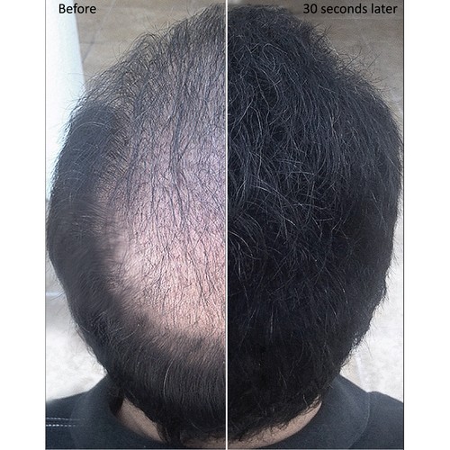 Samson BLACK Hair Building Fibers 300gr Best Hair Loss Concealer in The World - Picture 3 of 8