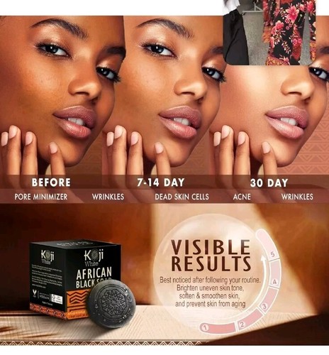 Feuchtigkeitsspendende schwarzafrikanische Seife für stumpfe, unebene Haut Aloe Vera Shea (2 Riegel) - Bild 4 von 6