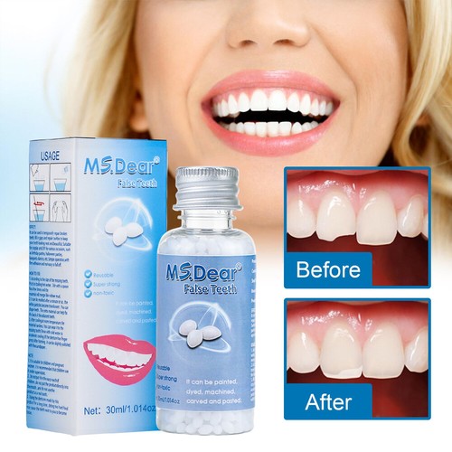 Temporary Tooth Repair Rubber False Teeth Solid Safety Filling Fix Glue Denture - Picture 13 of 17