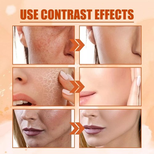 SADOER 5X Tonico Vitamina C, Vitamina C Coreana - FaceToner, Tonico Viso 5 En 1 US~~ - Foto 2 di 9