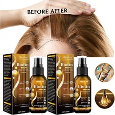 Biotin Hair Growth Spray Anti Hair Loss Fast Regrowth Scalp Treatment Serum