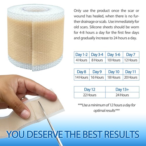 Reusable Silicone Scar Sheets Tape - Effective Scar Removal 1.6" x 60" 120" inch - Picture 13 of 22