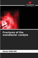 Fractures Of The Mandibular Condyle Hanen Hablani