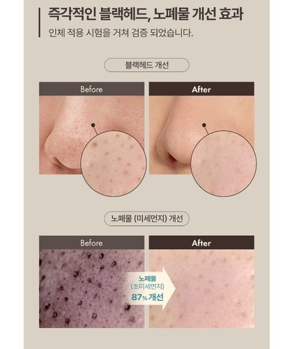 Bálsamo exfoliante OBge Blackhead Stick 20 g (0,70 oz) x 2 piezas para hombres y hombres cuidado de la piel Corea - Imagen 7 de 15