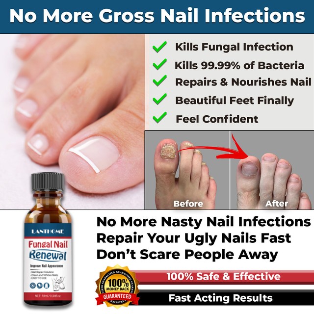 NEW ANTI FUNGAL NAIL REPAIR LIQUID INFECTION ANTIBACTERIAL TREATMENT TOE FINGER NEW ANTI FUNGAL NAIL REPAIR LIQUID INFECTION ANTIBACTERIAL TREATMENT TOE FINGER