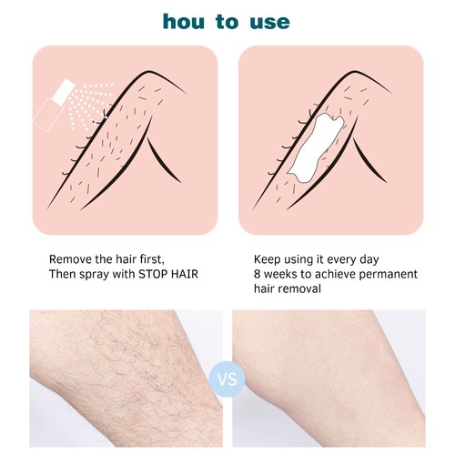5/3 Extra Strong Permanent Hair Removal Spray Stop Hair Growth Inhibitor Remover - Picture 12 of 16
