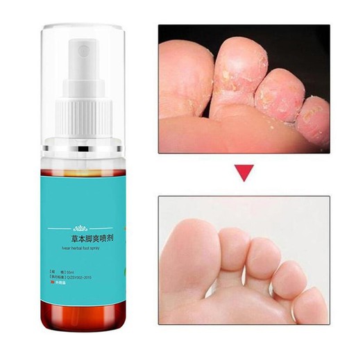 Spray para pies de atleta restaurar la salud de la piel 55 ml spray para pies diario para mujeres SG5 - Imagen 5 de 8