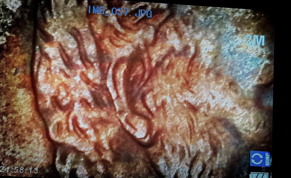 💎 ULTRA RARE MINT ERROR+ Lincoln Memorial Cent “DDO/DDR - Columns + Double Ear” - Image 2 of 3