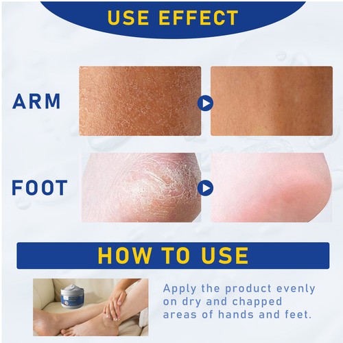 Foot Cream for Dry Cracked Repair Foot Lotion Natural Moisturizing Foot upgrade - Picture 7 of 12