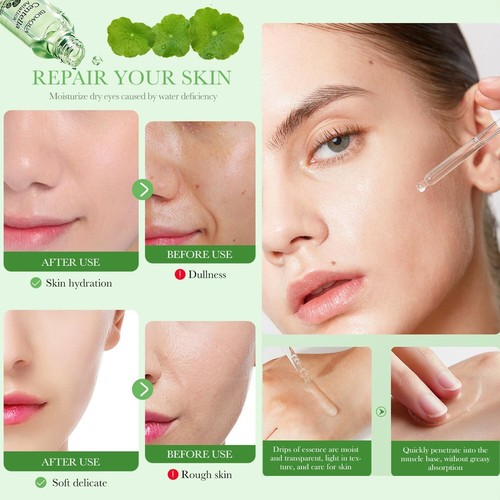 Serum for Face 30ml/1.01floz Face Hydrating Serum for Women - Repair - Anti Acne - Picture 5 of 7