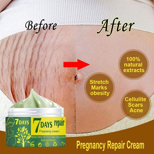 ✅ Pregnancy Scar Repair Cream Stretch Marks Removal Fat Stretch Mark Treatment - Picture 2 of 8