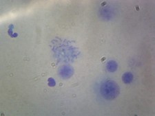 Female Chromosomes, Human; Smear