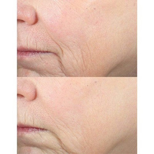 derma e Advanced Peptides & Collagen Serum 2 fl oz - New - Picture 6 of 10