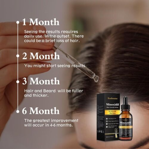 Minoxidil 5% Topical Solution for Men Hair Regrowth, Reactivates Follicles 60ml - Picture 6 of 8