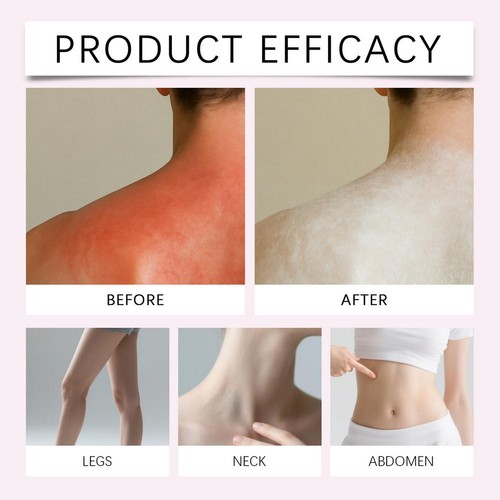 Quickly Absorbs Leaving Skin Dry and Comfortable2%C Without A Sticky Feeling - Picture 14 of 16