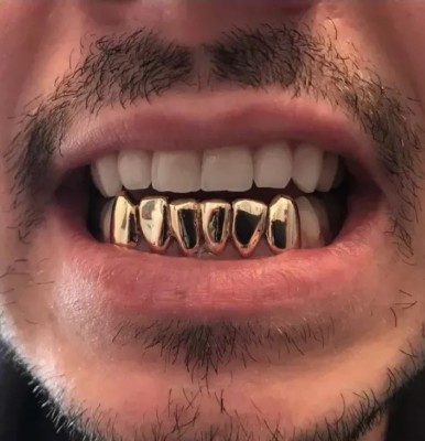 14k Solid Gold Grills With Deep Cut/Permanent Looking 6 Bottom Custom Fit | eBay