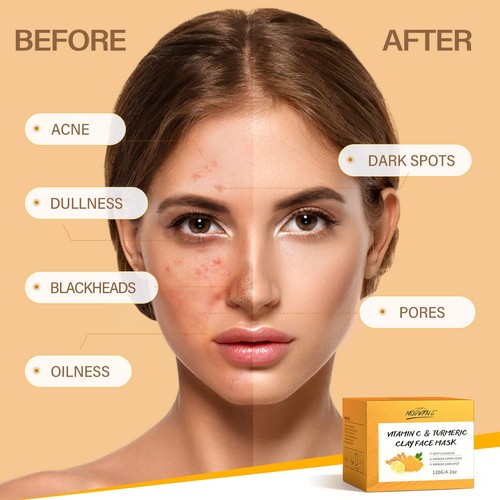 Turmeric Vitamin C Clay Mask Deep Cleansing Face Mask Skin Care Improve Blackhe - Picture 4 of 7