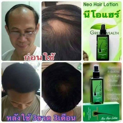 120ml. Neo Hair Lotion Hair Root HAIR BEARD SIDEBURNS LONGER Herbs 100% - Picture 10 of 11
