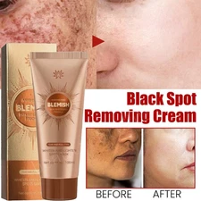 Herbal Spots Peel-Off Facial Mask Skin Whitening Deep Cleansing Pore Tightening