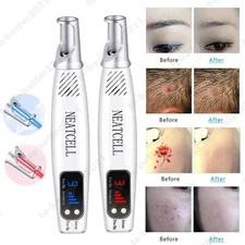 USB Picosecond Skin Pointer Beauty Laser Tattoo Removal Device Mole Removal Pen