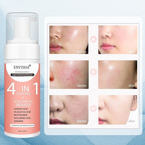 4in1 Facial Skin Care Exfoliating Mousse Peeling Gel Deep Cleaning Acne Removal - Picture 6 of 12