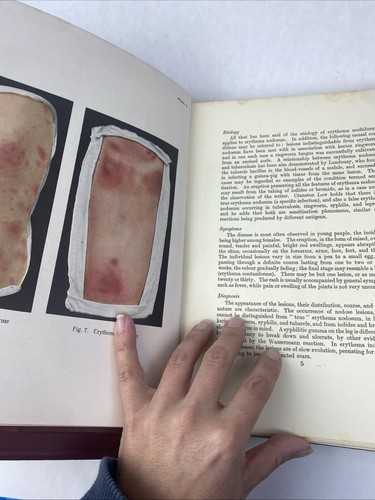 1927 Jacobi's Atlas of Dermochromes 4th Ed. 2 Volume Set Illustrated MacCormac - Picture 24 of 24