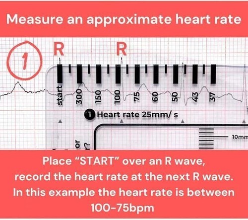 ECG/EKG 7 Step Ruler Card For ECG/EKG Interpretation,Portable ECG EKG Card-Ruler - Picture 5 of 13