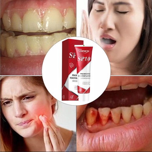 Sp 10 Pasta Dental Sp-8 Ultra Whitening Sp10 Probiotic Toothpaste - Picture 4 of 12