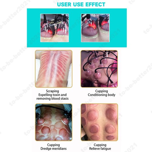 Breast & Buttock Enlargement Vacuum Therapy Machine Body Shaping Cupping Massage - Bild 8 von 13