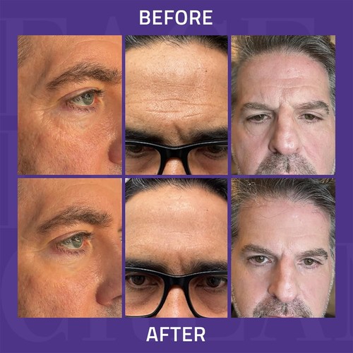 YEOUTH Instant Face Lift Cream, Temporary Skin Tightening Cream for Face, Under - Imagen 6 de 8
