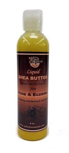 Liquid Shea Butter For Acne & Eczema - 第 1/1 張圖片