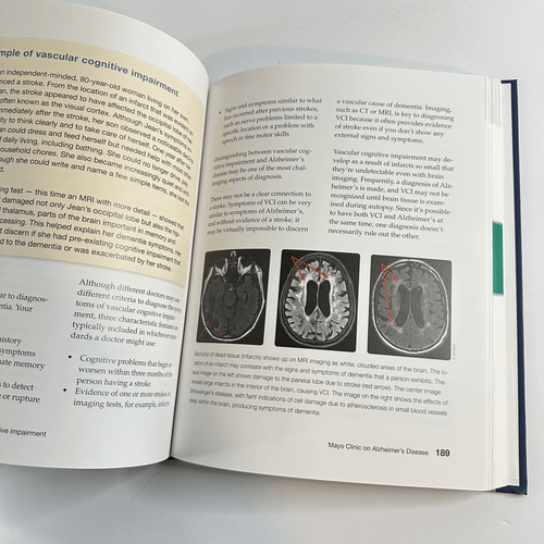 Mayo Clinic on Alzheimer’s Disease book by Experts at Mayo Clinic-2013 (HC) - Picture 5 of 11