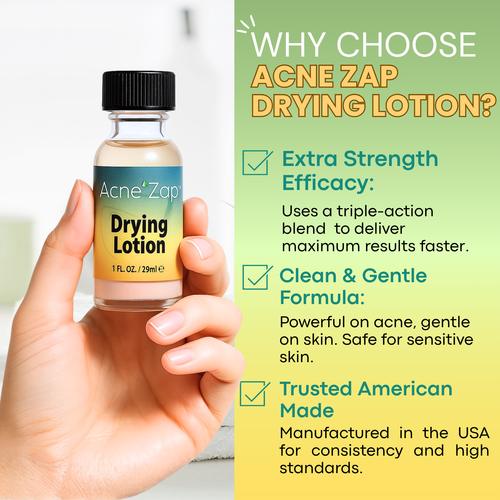 Akne Zap Trocknungslotion 1oz Akne Fleckenbehandlung über Nacht - Bild 6 von 7