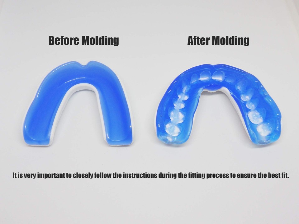 Boil and Bite Mouth Guard with Tether DBT Custom Sport Mouthpiece for