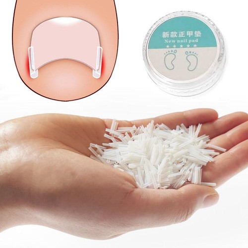 Corrector de uñas almohadilla de uñas encarnada ranura herramienta para el cuidado de los pies corrector de uñas de los pies 50 un. - Imagen 6 de 16