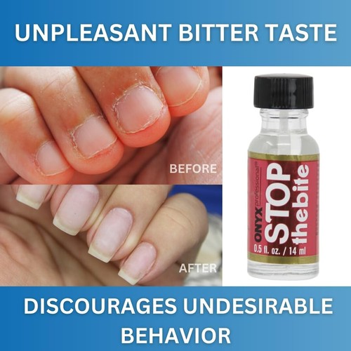 Stop the Bite Nail Biting Deterrent Polish 0.5 Fl Oz - Helps Nails Grow & Can... - Picture 4 of 10