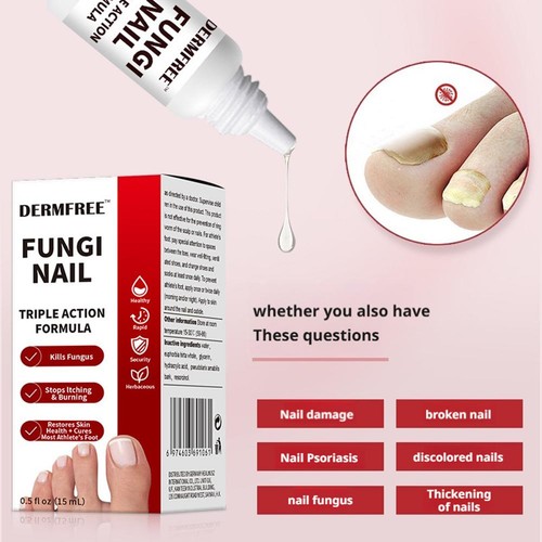 Nagelpilze Anti-Pilz flüssige Kräuterextrakte Zehennagelpilz Behandlung sicher✔ - Bild 7 von 13