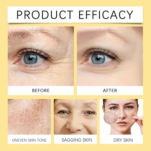 Wiyun Bee Venom Skin Cream Gentle nourishing care facial skin moisturizing best - Picture 7 of 7